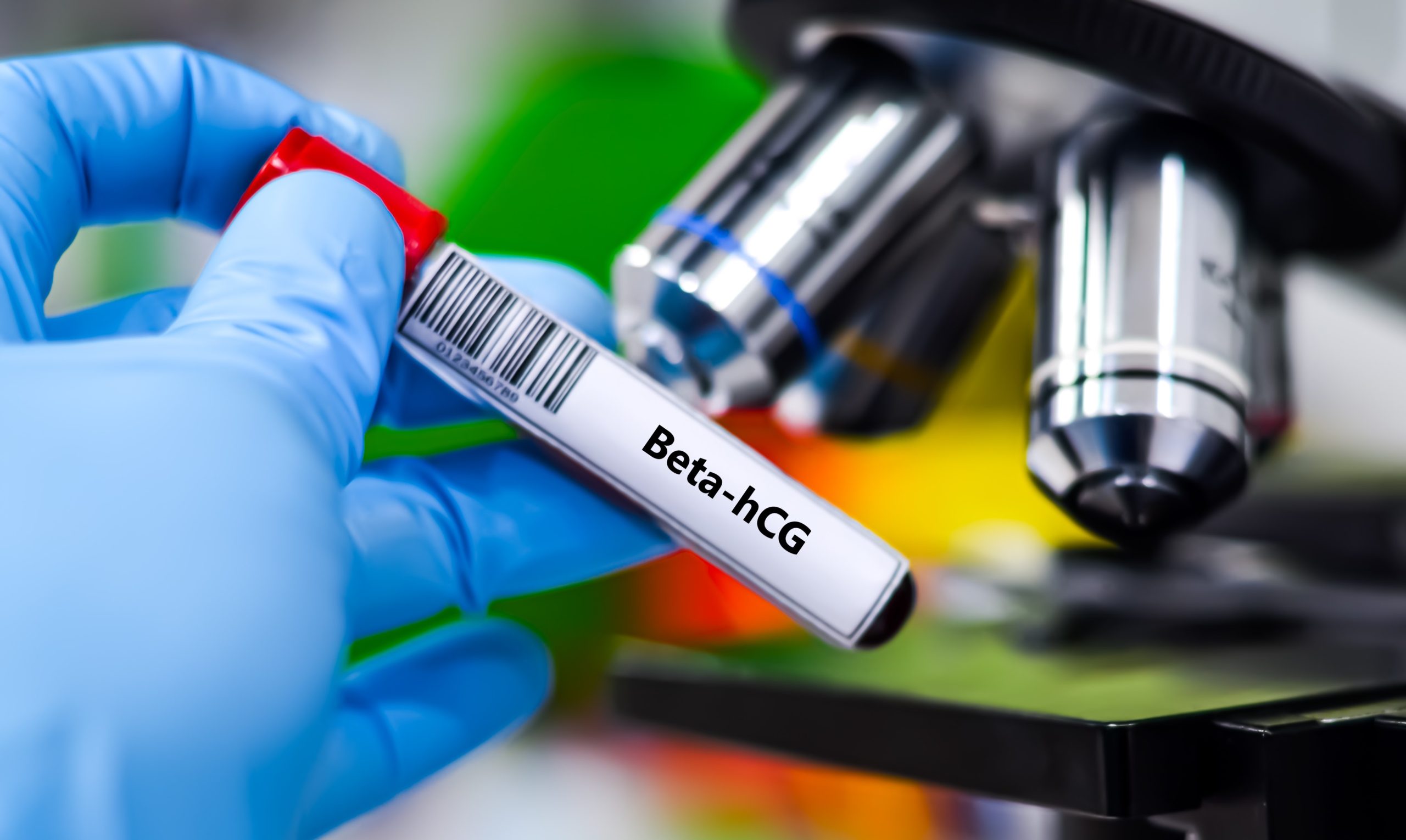 Test Beta Hcg